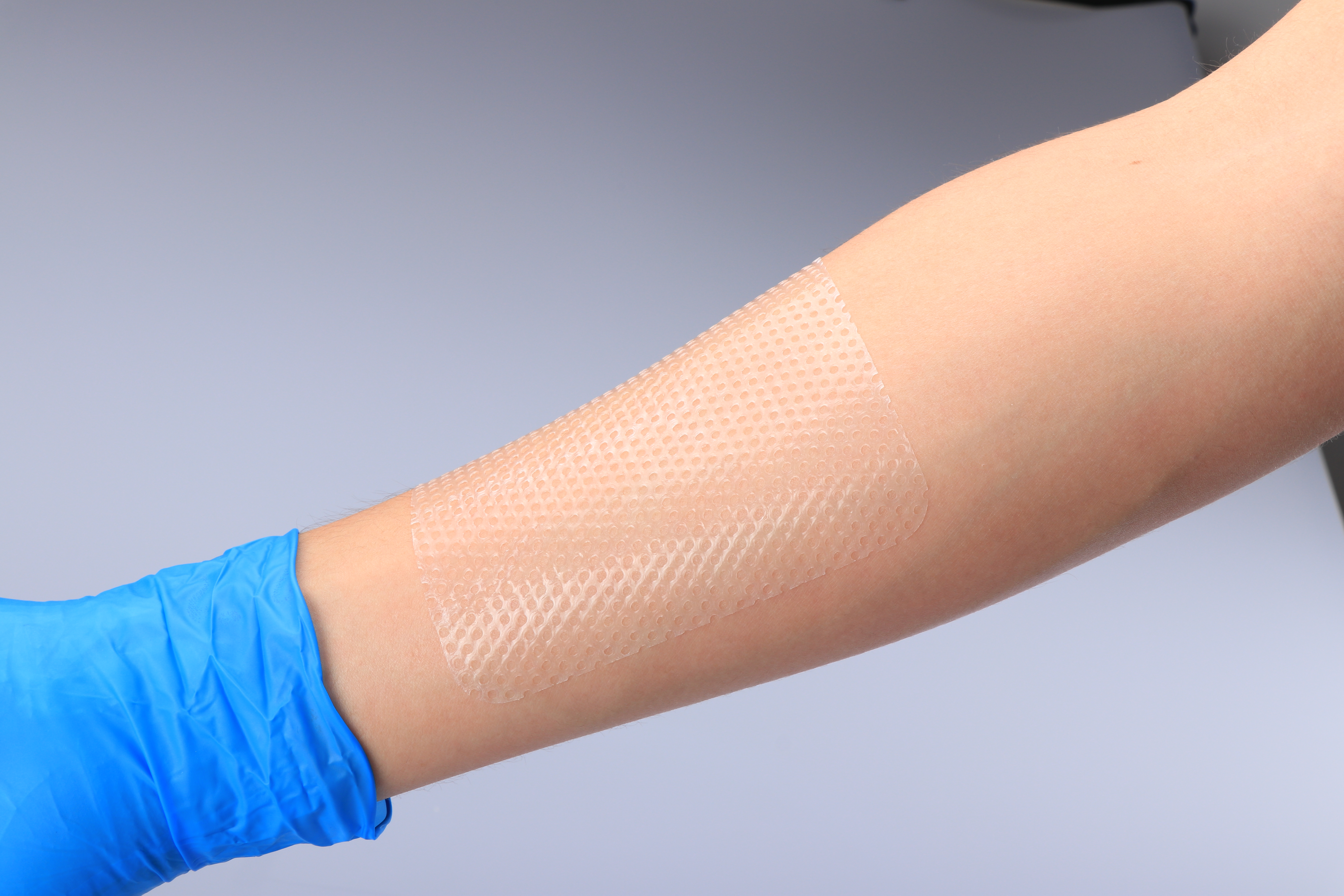 피부 보호 저자극 접착 실리콘 접촉층